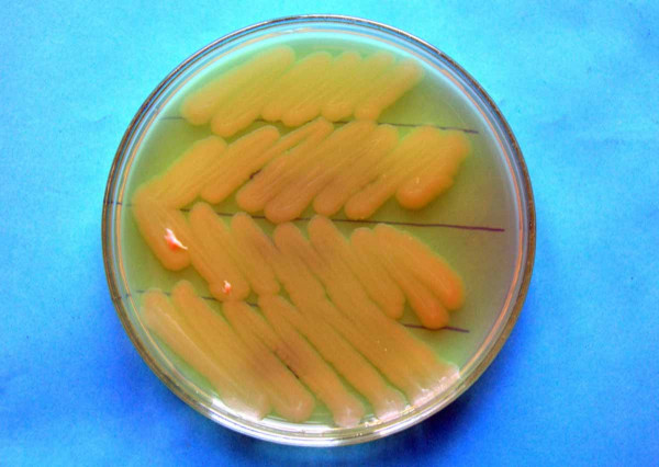 Bakteriální kolonie Pseudomonas marginalis