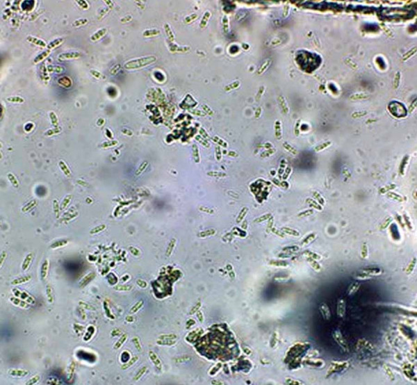 Obr. 5: Spory houby Fusarium avenaceum v mikroskopu