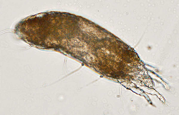 Obr. 15: Roztoč Aceria kuko - mikroskopický záber