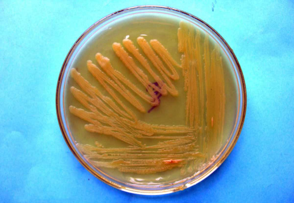 Bakteriální kolonie Pectobacterium carotovorum subsp. carotovorum