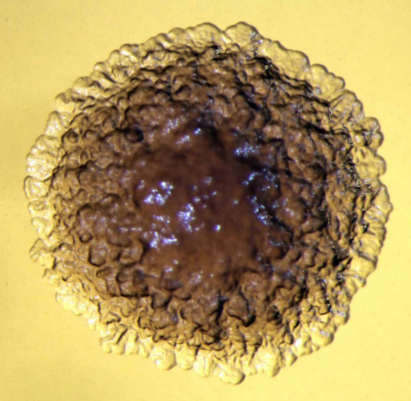 Kolonie pektinolytické bakterie Dickeya chrysanthemi na živném médiu