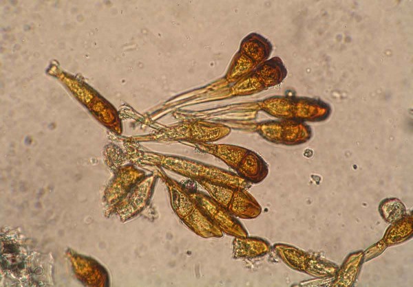 obr. 7: Teliospory